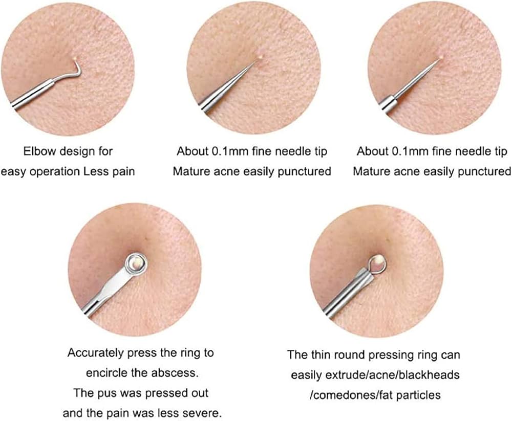 Problems Solved blackhead removal tool kit with four silver facial care tools and storage box for nose pore extraction.