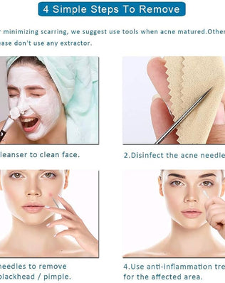 Problems Solved blackhead removal tool kit with four stainless steel tools and storage box for facial nose pore extraction.