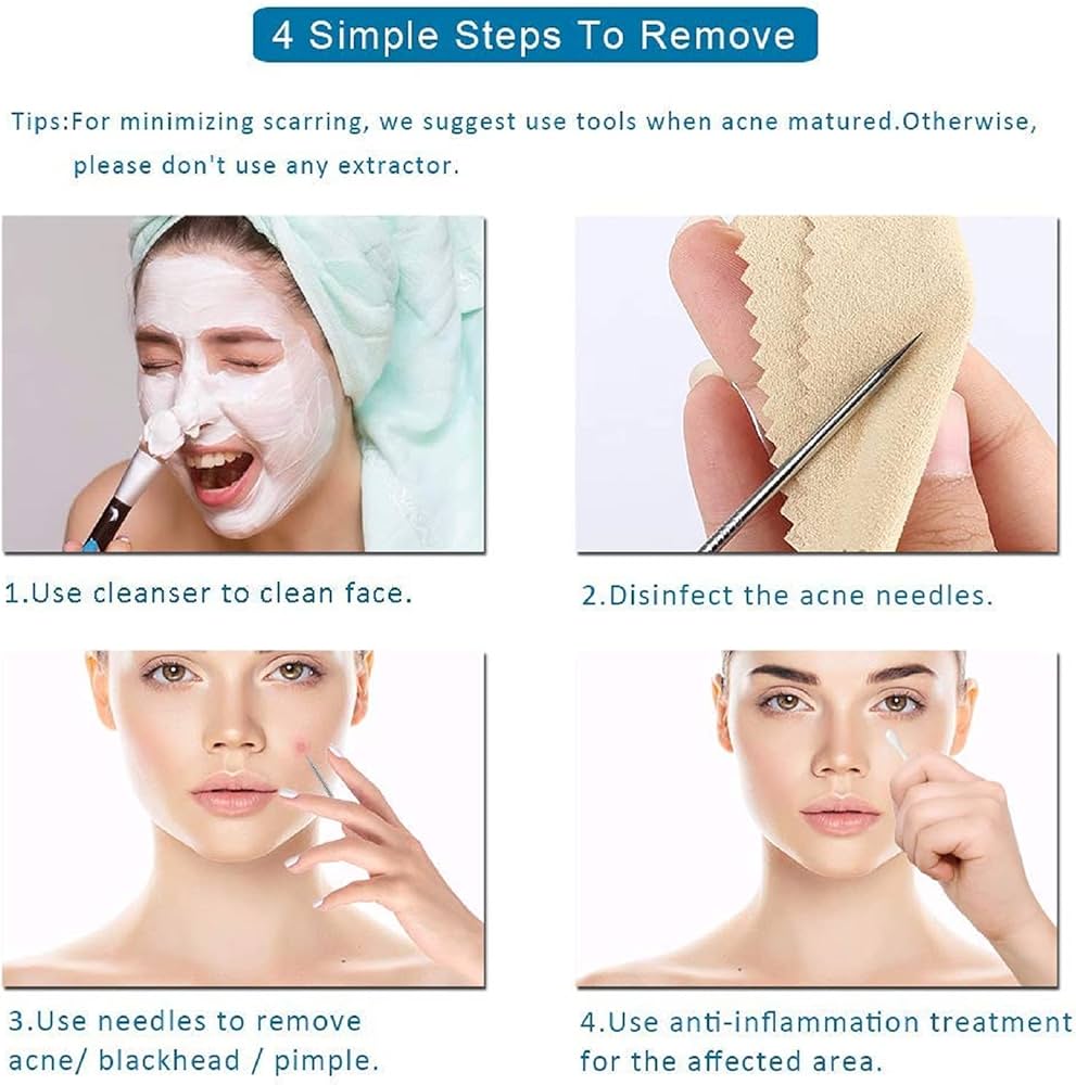 Problems Solved blackhead removal tool kit with four stainless steel tools and storage box for facial nose pore extraction.
