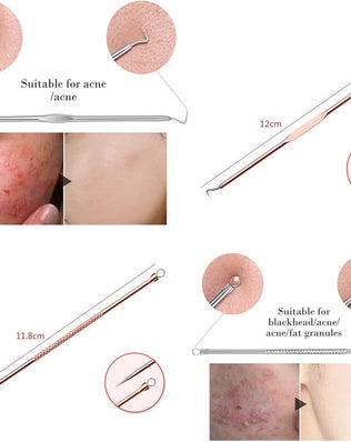 Blackhead Remover Pimple Comedone Extractor Tool Best Acne Removal Kit
