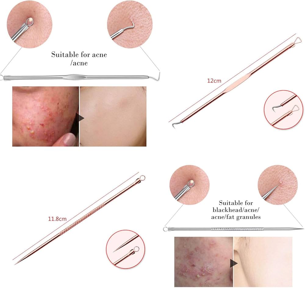 Blackhead Remover Pimple Comedone Extractor Tool Best Acne Removal Kit