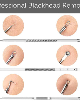 Problems Solved 4-piece blackhead removal tool kit with silver tools and storage box for nose and facial skin care.