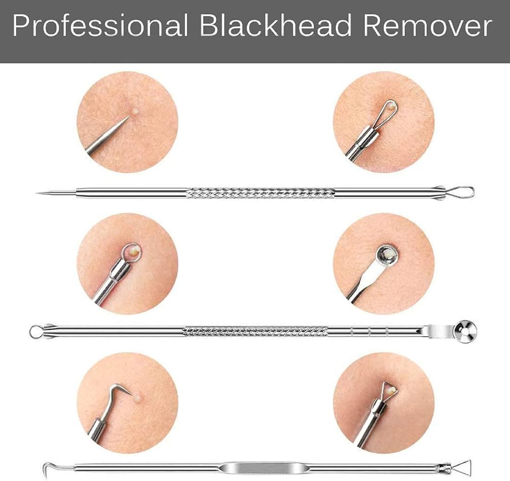 Problems Solved 4-piece blackhead removal tool kit with silver tools and storage box for nose and facial skin care.
